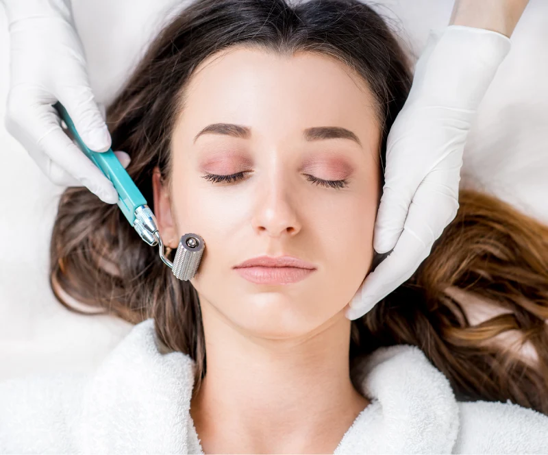 Ideal Smile Dental | Microneedling