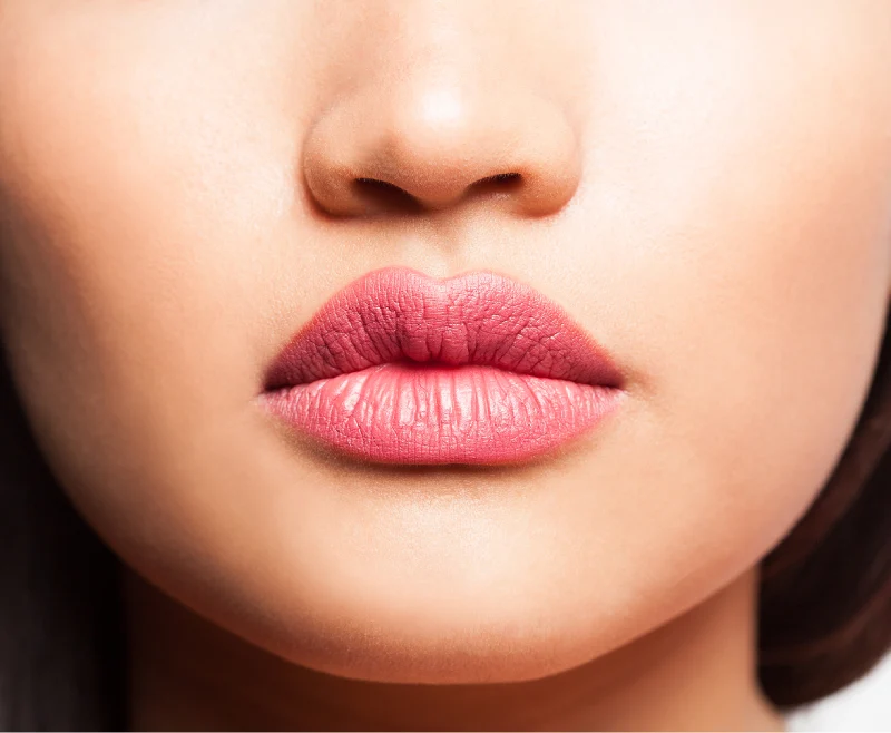 Ideal Smile Dental | Lip Filler