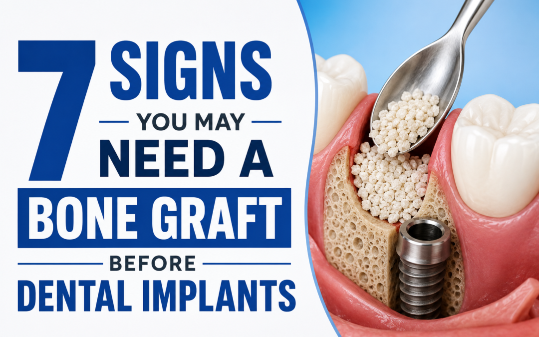 Ideal Smile Dental | 7 Signs You May Need a Bone Graft Before Dental Implants